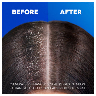 Menthol Fresh Anti-Dandruff Shampoo 400ml.Against Dandruff, Oil and Itch thumbnail 4