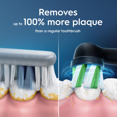 Pro Series 1 Electric Toothbrush thumbnail 4