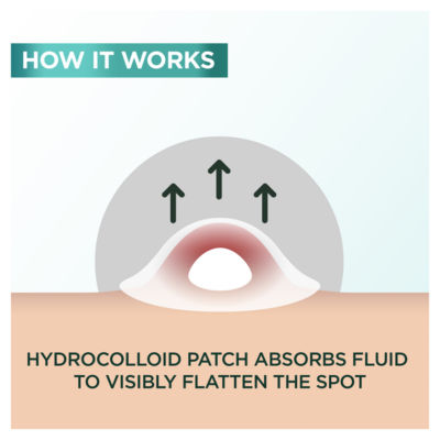Blemish Patches, Ultra-thin & Invisible, Reduce the Appearance of Spots in 8H, 22 Patches thumbnail 4