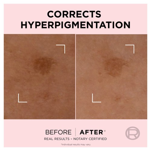 L'Oreal Skin Expert Age Perfect Spot Corrector  thumbnail 3