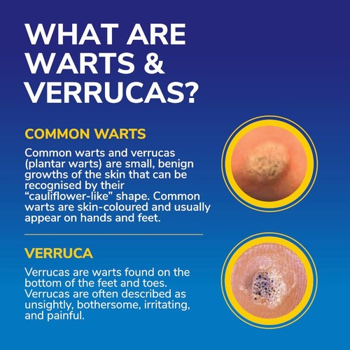 Dr Scholl's Wart & Verruca Freeze Away Max 63g thumbnail 5