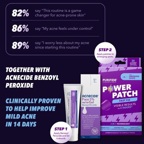 Acnecide Spot Treatment with Benzoyl Peroxide thumbnail 7