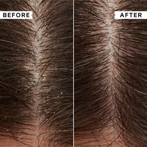 Philip Kingsley Flaky/Itchy Scalp Shampoo thumbnail 2
