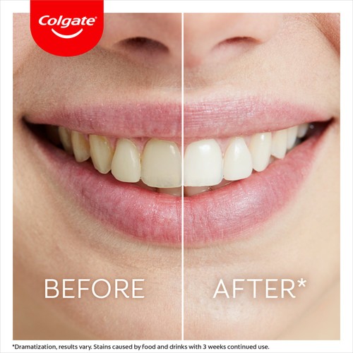 Colgate Max White Whiten At Home Teeth Whitening Pen  thumbnail 5