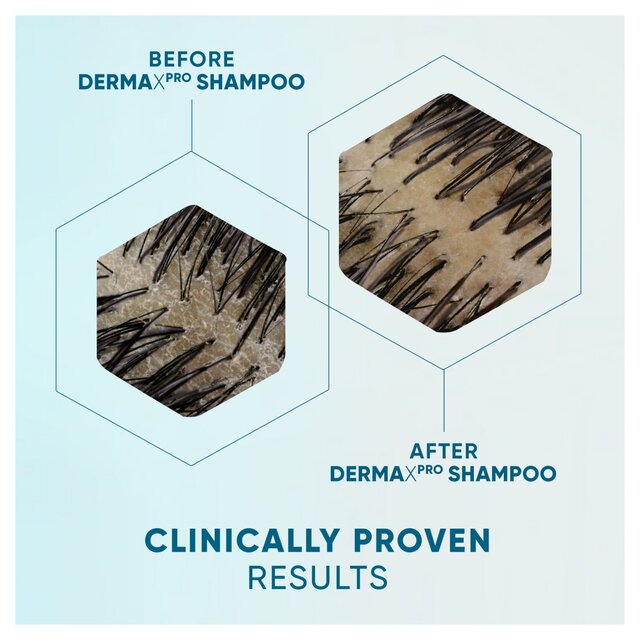 Head & Shoulders Derma X Pro Soothe Shampoo thumbnail 10