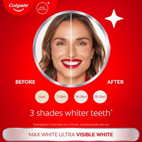 Colgate Max White Ultra Active Foam At Home Teeth Whitening Toothpastee thumbnail 8