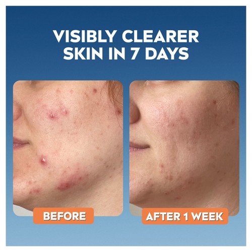 NIVEA Derma Skin Clear Toner thumbnail 3