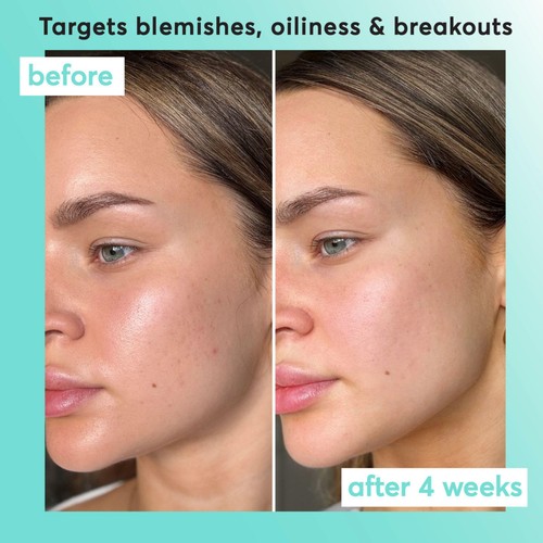 Super Facialist Clear Skin Pore-fect Daily Moisturiser thumbnail 3