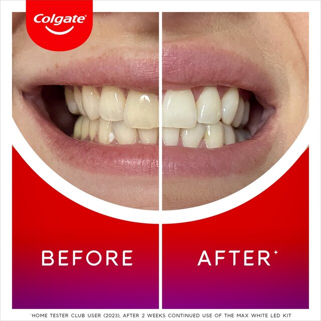 Colgate Max White Ultimate At Home LED Teeth Whitening Kit thumbnail 7