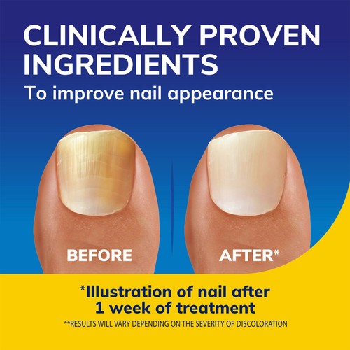 Dr Scholl's Nail Revitaliser Serum thumbnail 6