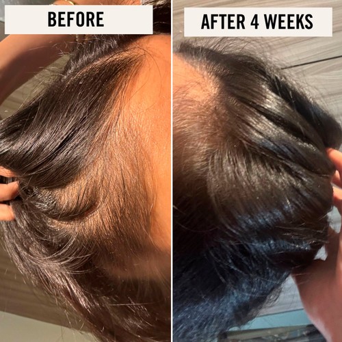UpCircle Scalp + Hair Oil with Bacuri Butter and Castor Oil thumbnail 3