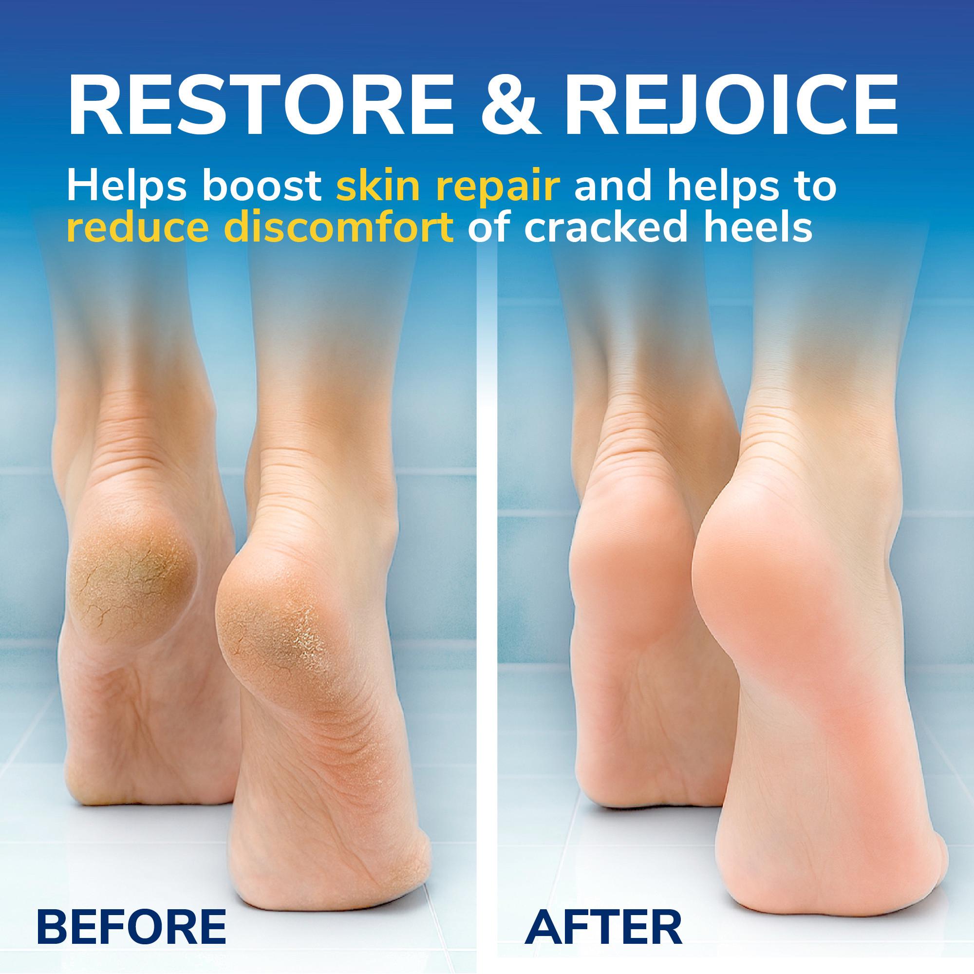 Scholl Cracked Heel Foot Cream Balm 60ml thumbnail 4