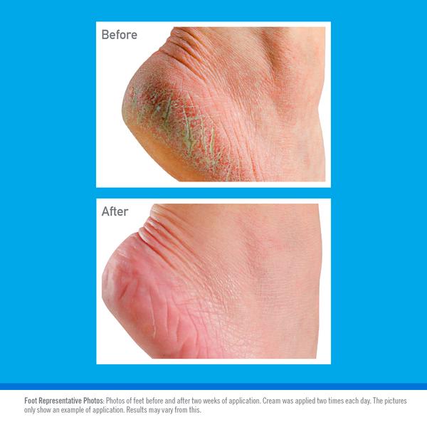 O'Keeffe's for Healthy Feet Foot Cream 91g thumbnail 5