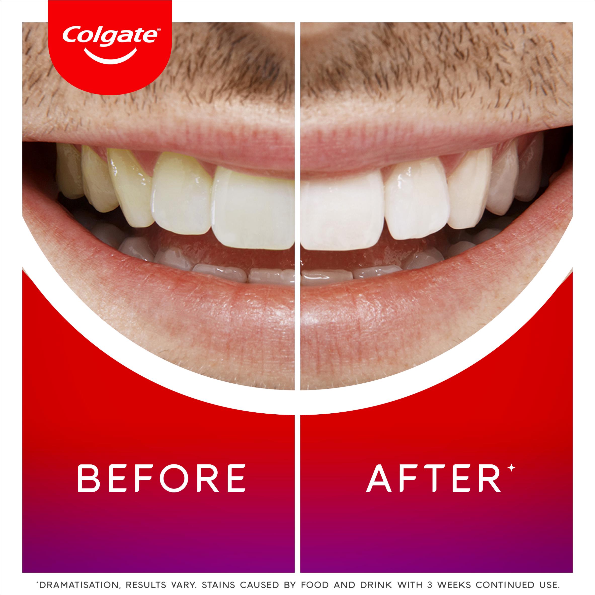 Colgate Max White Overnight Teeth Whitening Serum 2.5ml thumbnail 3
