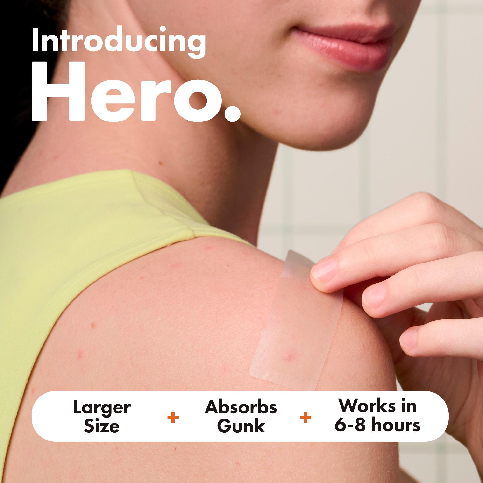Hero 10 Mighty Surface Spot Pimple Patches thumbnail 2