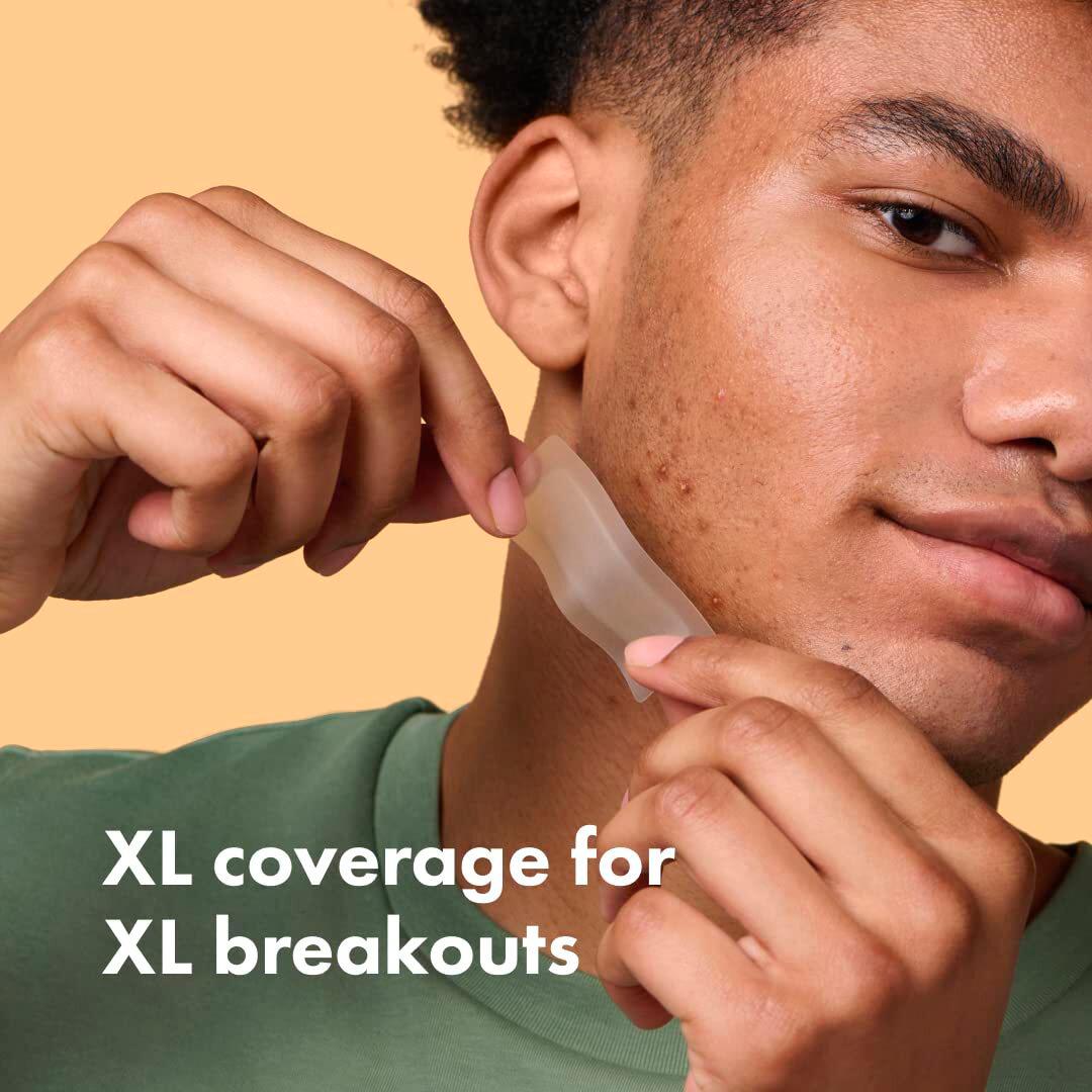 Hero 10 Mighty Surface Spot Pimple Patches thumbnail 5