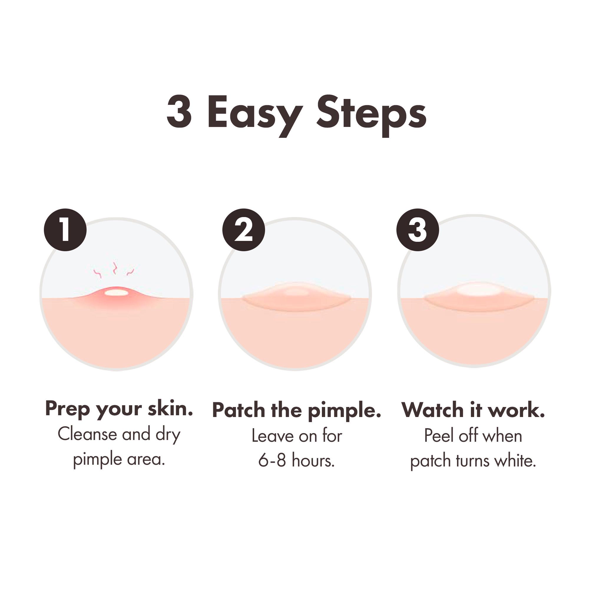 Hero 10 Mighty Surface Spot Pimple Patches thumbnail 6