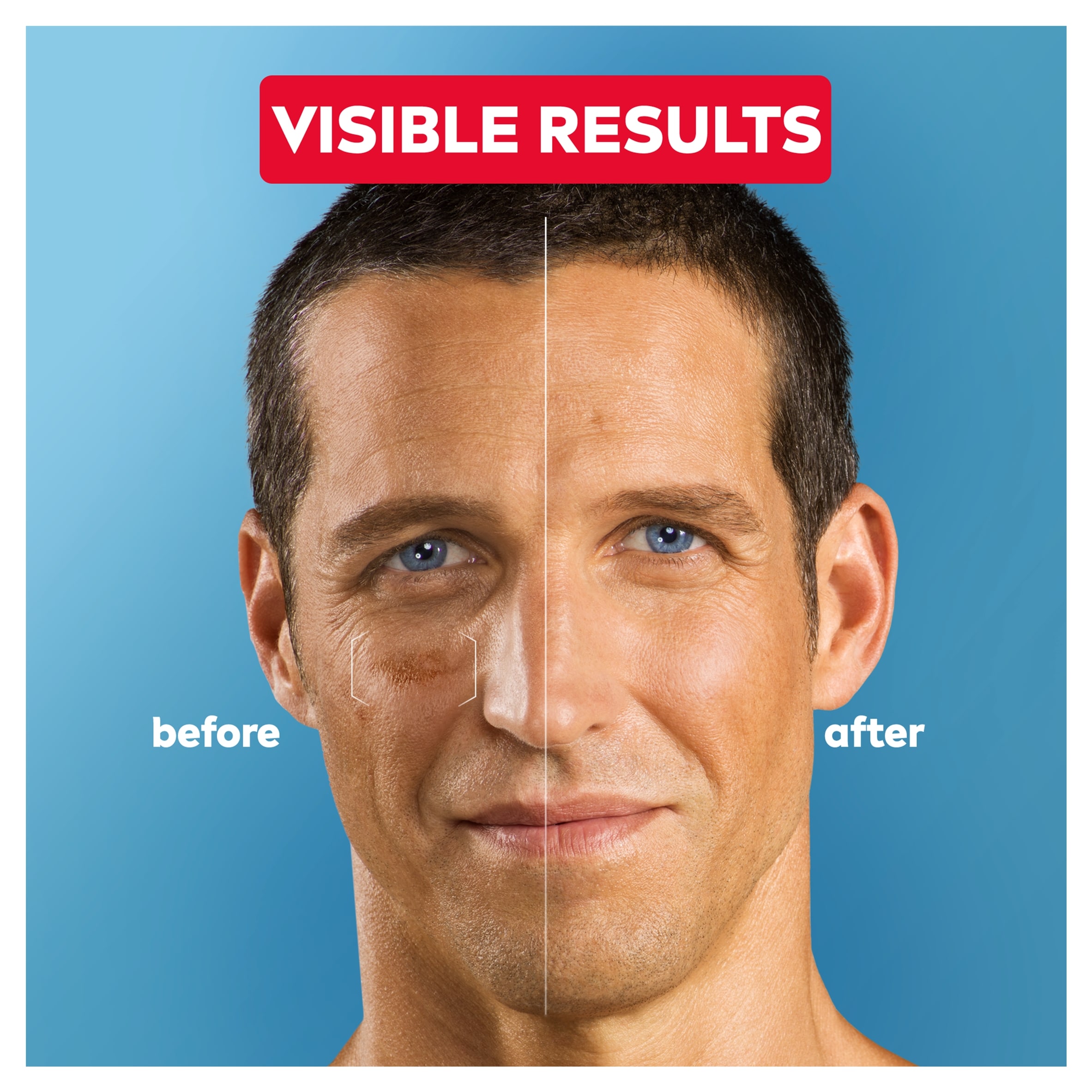 NIVEA MEN 2in1 Anti-Age Power Serum 30ml thumbnail 3