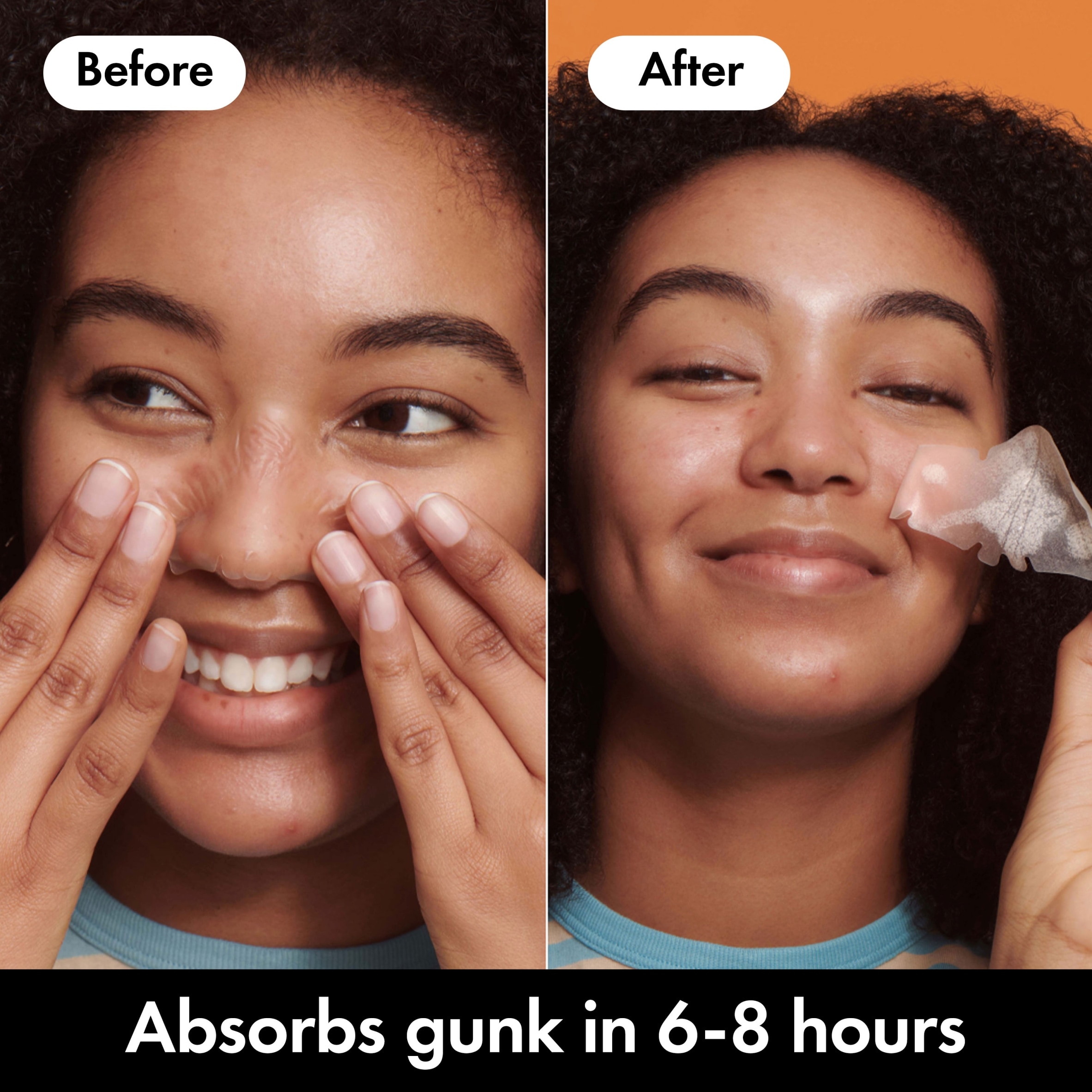 Hero Mighty Patch Hydrocolloid Nose Patches x10 thumbnail 4