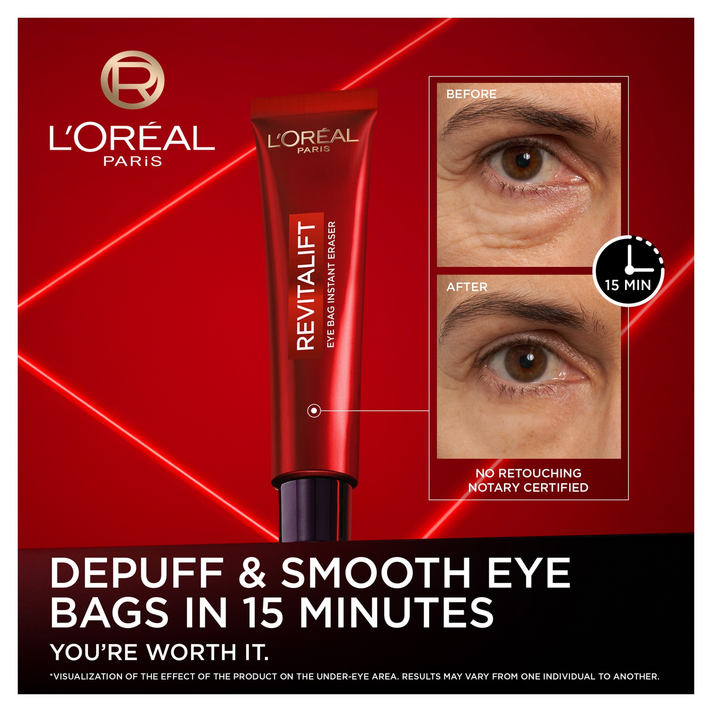 L’OREAL PARIS REVITALIFT LASER EYE BAG INSTANT ERASER 15 ml thumbnail 2